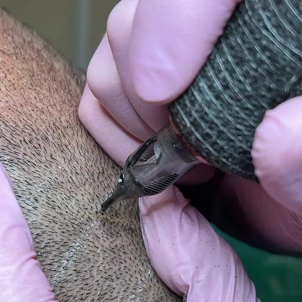 Técnica de micropigmentación capilar en Sevilla